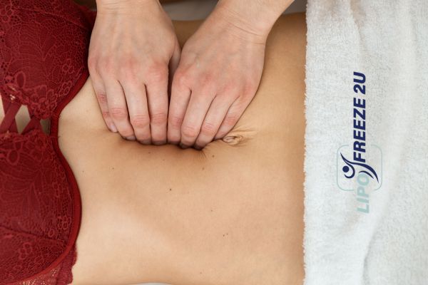 diastasis recti treatment Milngavie