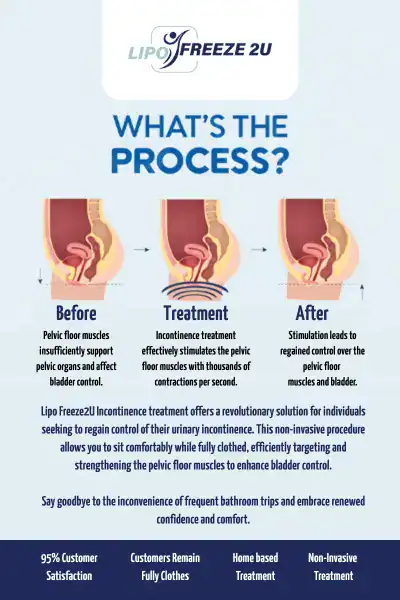 Diagram of how incontinence treatment Milngavie works.