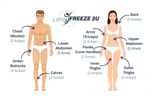 Areas you can have fat freezing treatment Milngavie