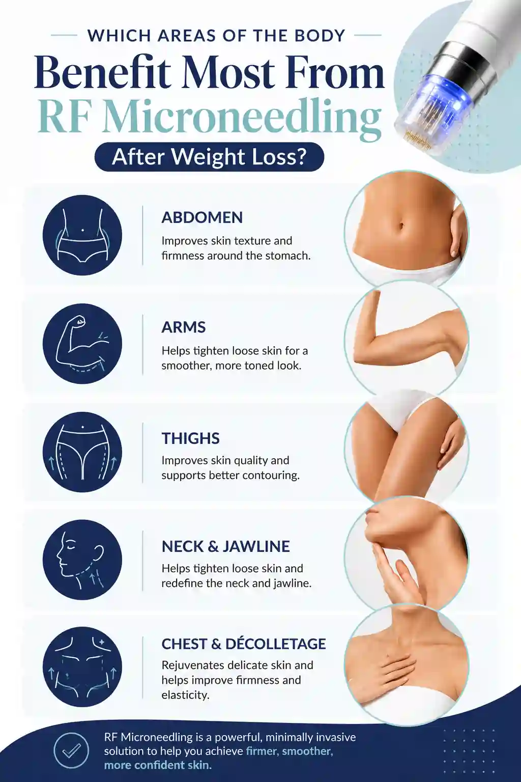 Which Areas of the Body Benefit Most From RF Microneedling After Weight Loss Milngavie